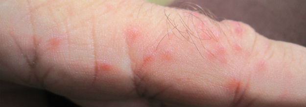 finger spots finger spotsfinger spots