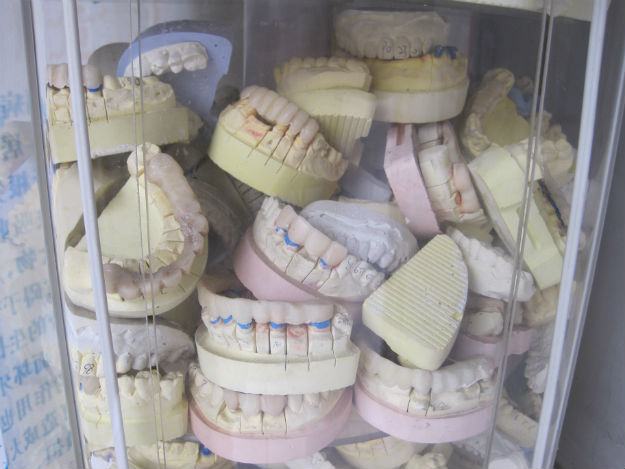 chinese dentures